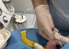 Медики двух больниц провели экстренную операцию новорожденной: редчайший случай в Латвии