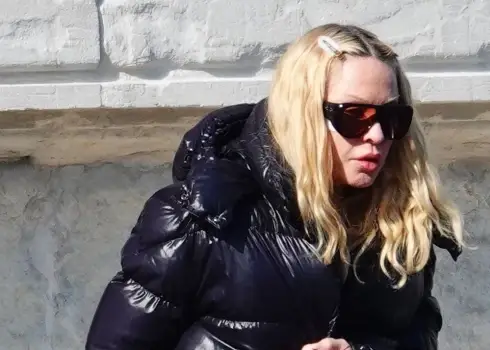 Мадонна в Венеции скрывает пластырь на щеке (март 2026)